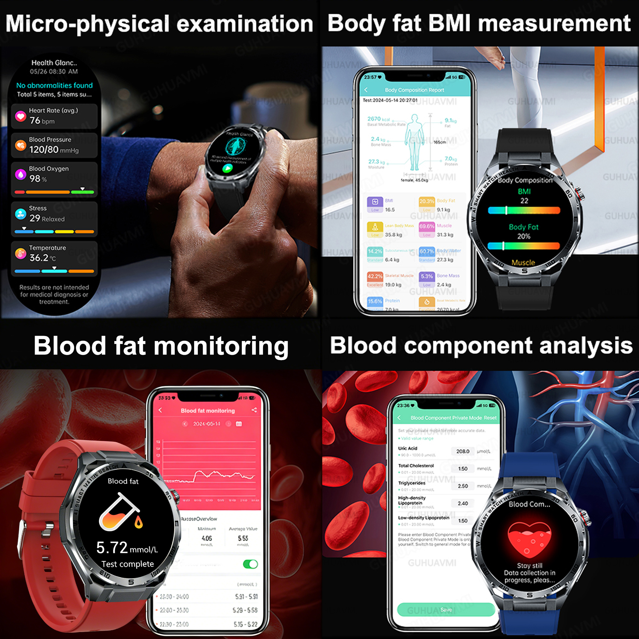 2026 New Body Fat AI Analysis  - Android Smartwatch Accessories recensie en prijs